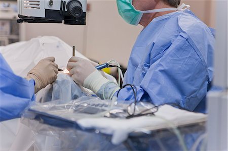 Surgical technologist irrigating eye and doctor using phaco with cracker instrument during cataract surgery Foto de stock - Sin royalties Premium, Código: 6105-05396749