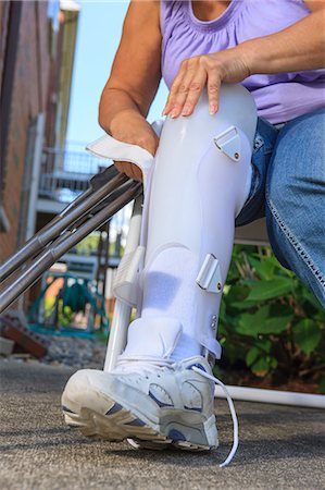 Woman with Spina Bifida adjusting leg brace so she can walk Fotografie stock - Premium Royalty-Free, Codice: 6105-08211309