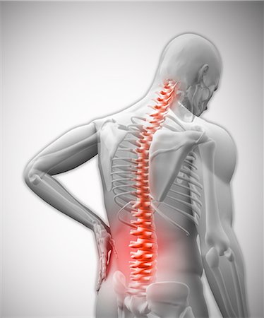 dolorido - Digital human with highlighted vertebrae in pain Foto de stock - Sin royalties Premium, Código: 6109-06685039