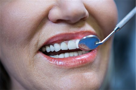 simsearch:6109-08700876,k - Close-up of patient's teeth being examined with angle mirror at dentists clinic Foto de stock - Royalty Free Premium, Número: 6109-08700847