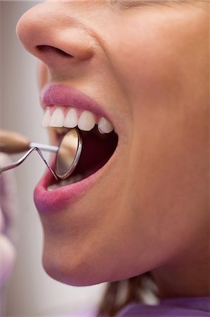 simsearch:6109-08700876,k - Close-up of dentist examining a female patient with tools at dental clinic Foto de stock - Royalty Free Premium, Número: 6109-08803920