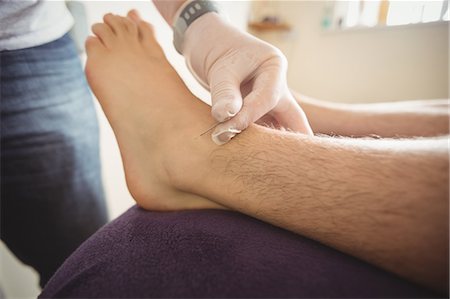 Physiotherapist performing dry needling on the leg of a patient Stock Photo - Premium Royalty-Free, Code: 6109-08829773