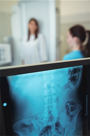 female pelvis - Close-up of x-ray monitor Stock Photo - Premium Royalty-Free, Code: 6109-08830175