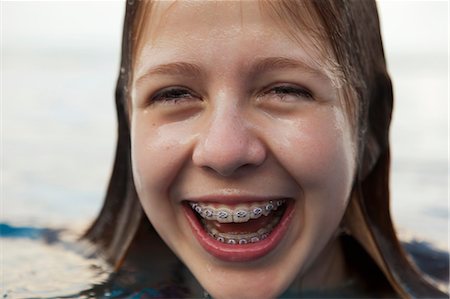 preteen wet - Smiling girl revealing braces Stock Photo - Premium Royalty-Free, Code: 6122-07707463