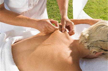 simsearch:614-08865470,k - Man having acupuncture outdoors Stock Photo - Premium Royalty-Free, Code: 6122-08212221