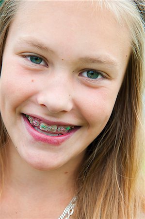 preteen girls faces close ups - Portrait of girl (12-13) in braces smiling Stock Photo - Premium Royalty-Free, Code: 6126-08580638
