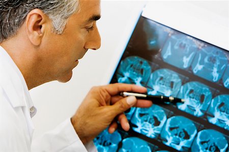 simsearch:625-01252198,k - Side profile of a male doctor examining an X-Ray Foto de stock - Royalty Free Premium, Número: 625-01252308