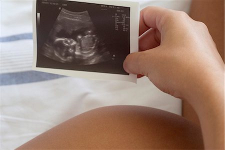 simsearch:632-06318000,k - Pregnant woman holding ultrasound, cropped Fotografie stock - Premium Royalty-Free, Codice: 632-05554059