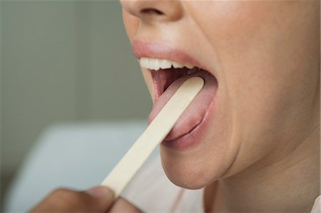Femme jouissant de la bouche a examiné avec abaisse-langue, recadrée Photographie de stock - Premium Libres de Droits, Code: 632-06354201