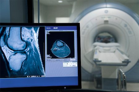 diagnostic - MRI scan result on computer monitor Stock Photo - Premium Royalty-Free, Code: 632-03629878