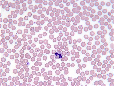 Malarial blood cells Foto de stock - Sin royalties Premium, Código: 649-05801927