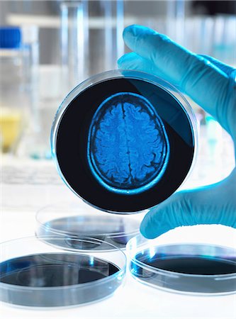 Scientist holding a petri dish with a brain scan illustrating research into dementia, alzheimers and other brain disorders. Stock Photo - Premium Royalty-Free, Code: 649-08118569