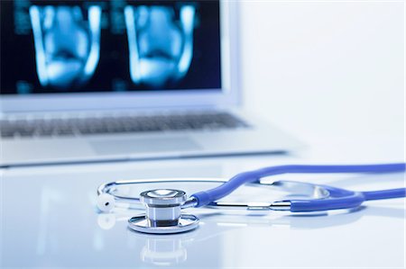 Modern orthopedics. Acoustic stethoscope and a laptop computer displaying MRI images of a knee Stockbilder - Premium RF Lizenzfrei, Bildnummer: 649-08144852