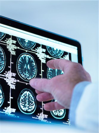 Doctor viewing a series of MRI (Magnetic Resonance Imaging) brain scans on a screen Photographie de stock - Premium Libres de Droits, Code: 649-08306838