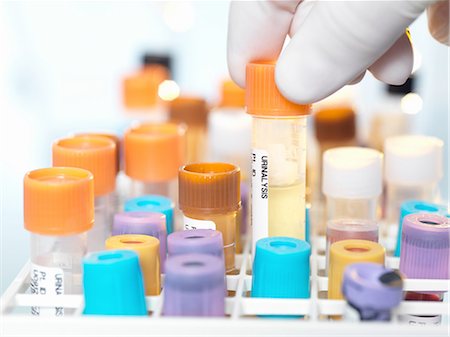 Laboratory technician preparing urine sample for medical testing in laboratory Photographie de stock - Premium Libres de Droits, Code: 649-08479875