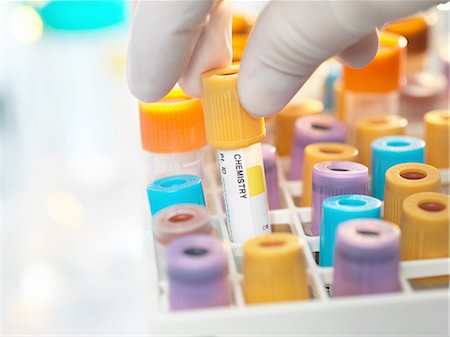 results - Laboratory technician preparing human chemistry sample for medical testing in laboratory Stock Photo - Premium Royalty-Free, Code: 649-08479876