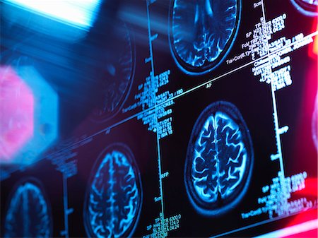 diagnostique - Human brain scan in a neurology clinic Foto de stock - Sin royalties Premium, Código: 649-08543116