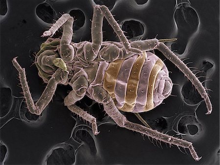 scanning electron micrograph images - High vacuum SEM image of plant lice Stock Photo - Premium Royalty-Free, Code: 649-08562204