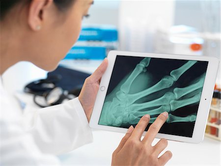 fratura - Doctor viewing X-ray of hand on digital tablet Foto de stock - Royalty Free Premium, Número: 649-08703434