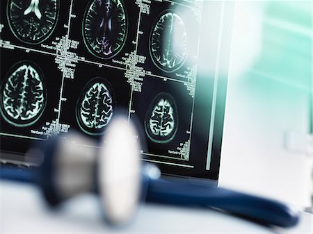 Series of MRI brain scans on computer screen with stethoscope in foreground on doctor's desk Stockbilder - Premium RF Lizenzfrei, Bildnummer: 649-08859696
