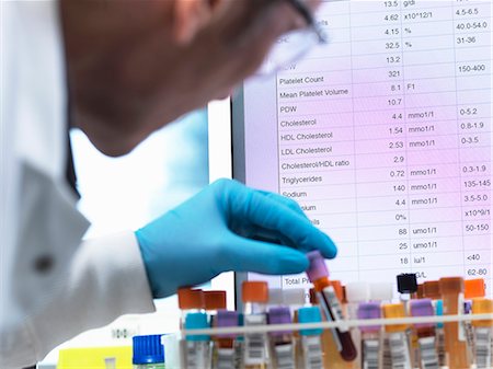 Medical Testing, Haematologist checking medical samples including blood for testing with results on the computer screen Foto de stock - Sin royalties Premium, Código: 649-08894990