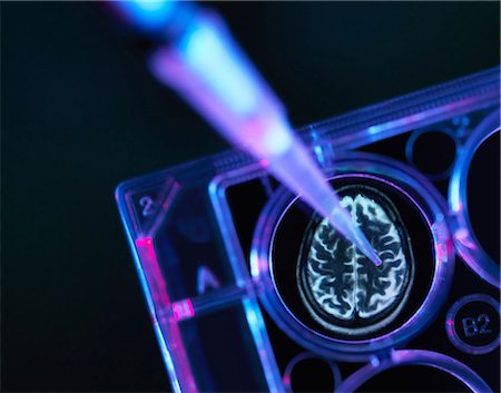 dementia - Alzheimer's and dementia research, a brain scan in multi well tray used for research experiments in laboratory Stock Photo - Premium Royalty-Free, Code: 649-09036367