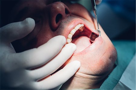 simsearch:649-09138892,k - Dentist carrying out dental procedure on male patient, close-up Foto de stock - Sin royalties Premium, Código: 649-09138884