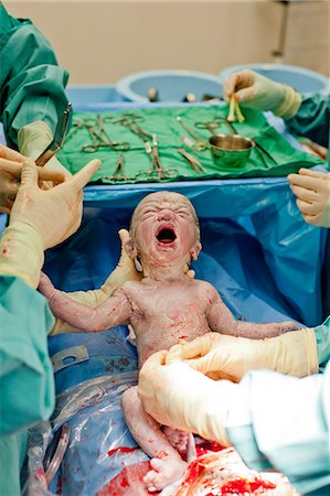 Baby being born via cesarian section operation Photographie de stock - Premium Libres de Droits, Code: 640-08546219