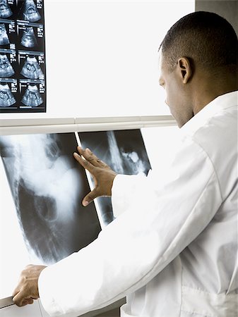 Male doctor looking at chest x-rays Stock Photo - Premium Royalty-Free, Code: 640-02765081