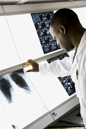 Male doctor looking at chest x-rays Stock Photo - Premium Royalty-Free, Code: 640-02765082