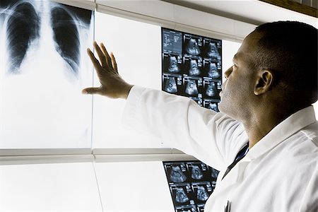 Male doctor looking at chest x-rays Stock Photo - Premium Royalty-Free, Code: 640-02771779