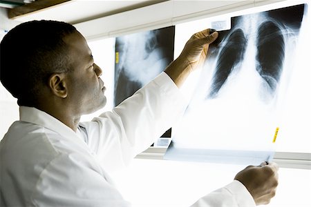 Male doctor looking at chest x-rays Stock Photo - Premium Royalty-Free, Code: 640-02771781