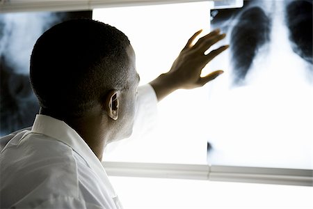 patient record - Male doctor looking at chest x-rays Stock Photo - Premium Royalty-Free, Code: 640-02771782