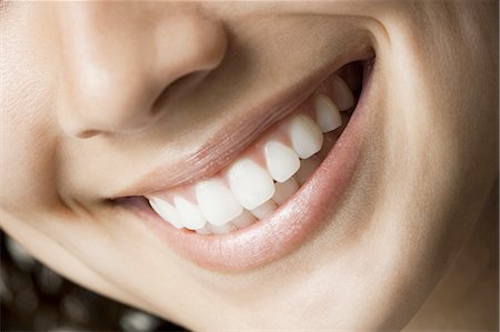 dentistry - Close-up of smile Stock Photo - Premium Royalty-Free, Code: 640-03255591