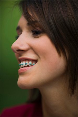 Teenage girl smiling with braces Fotografie stock - Premium Royalty-Free, Codice: 640-03259851
