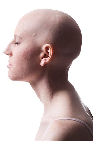 single bald women - Bald woman Stock Photo - Premium Royalty-Free, Code: 640-03264086