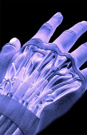 extensor digit minimi tendon - The muscles of the hand Stock Photo - Premium Royalty-Free, Code: 671-02094267