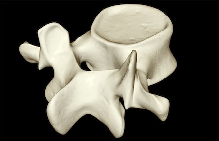 spinous process - Lumbar vertebra Stock Photo - Premium Royalty-Free, Code: 671-02094466