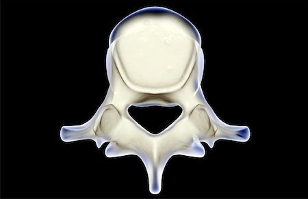 spinous process - Lumbar vertebra Stock Photo - Premium Royalty-Free, Code: 671-02094940