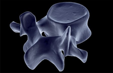 spinous process - Lumbar vertebra Stock Photo - Premium Royalty-Free, Code: 671-02095483