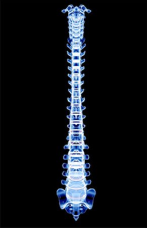 The vertebral column Foto de stock - Sin royalties Premium, Código: 671-02096382