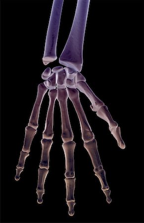 The bones of the hand Stock Photo - Premium Royalty-Free, Code: 671-02096416