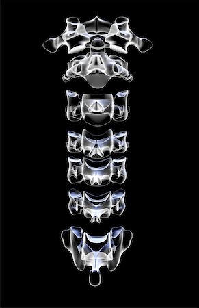 The cervical vertebrae Foto de stock - Sin royalties Premium, Código: 671-02096833