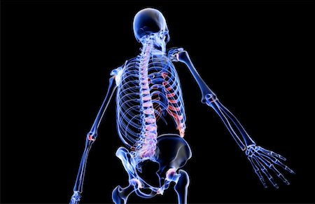 simsearch:671-02096698,k - The bones of the upper body Stock Photo - Premium Royalty-Free, Code: 671-02096895