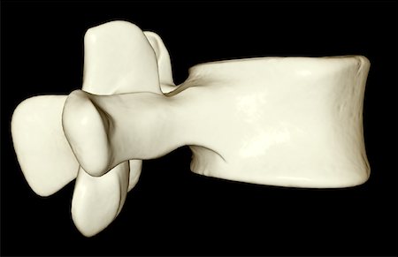 spinous process - Lumbar vertebra Stock Photo - Premium Royalty-Free, Code: 671-02097021