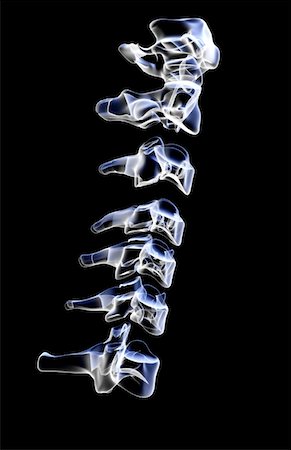 skeleton close up of neck - The cervical vertebrae Stock Photo - Premium Royalty-Free, Code: 671-02097201