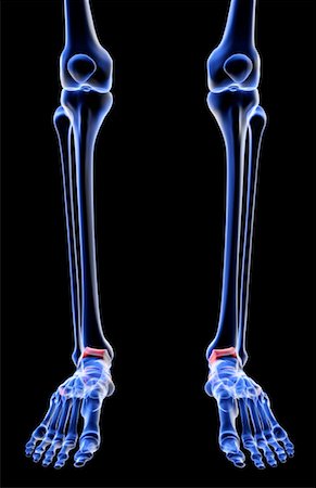 simsearch:671-02095525,k - The bones of the leg Stock Photo - Premium Royalty-Free, Code: 671-02097559