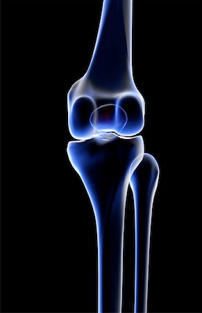 simsearch:671-02101509,k - The bones of the knee Stock Photo - Premium Royalty-Free, Code: 671-02097704