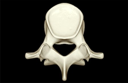 spinous process - Lumbar vertebra Stock Photo - Premium Royalty-Free, Code: 671-02098401