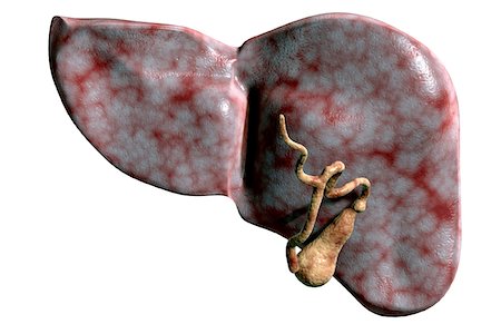 Gall bladder and liver Stock Photo - Premium Royalty-Free, Code: 671-02099008